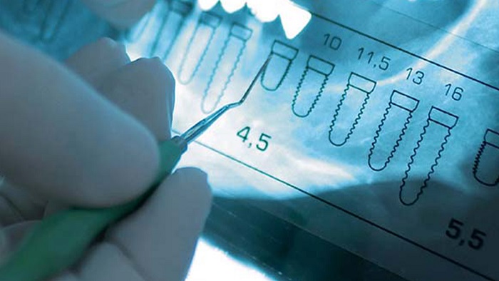 A person marking onto a dental equipment that has various sizes of teeth shapes.